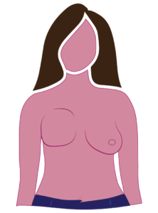 Diagram Of Radical Mastectomy Fullness Surgical Side