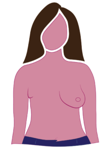 Diagram Of Radical Mastectomy Mostly Flat Surgical Side
